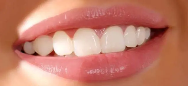 prothèses dentaire tunisie