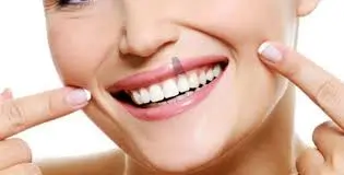 suivi post opératoire d'une opération implant dent