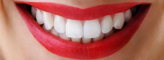 facette glamsmile Tunisie